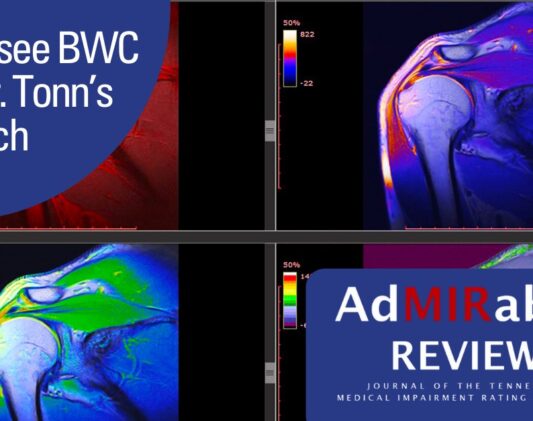 652fe6265306a15707ca0b26_Tennessee BWC Cites Dr. Tonn Research 652fe6265306a15707ca0b26_Tennessee BWC Cites Dr. Tonn Research